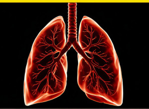 Раннє виявлення раку легенів